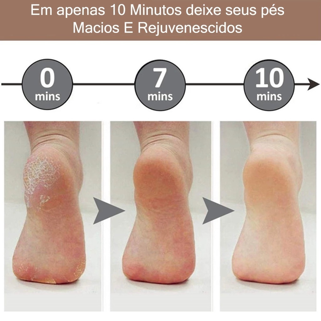 Lixador de Pé Elétrico - Esfoliador Tira Calos Pedicure Portátil Lixa Elimina Calo Portátil Usb Pilha